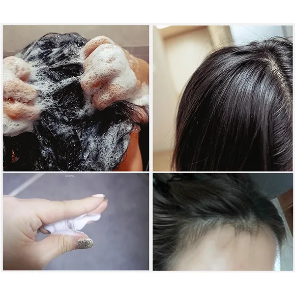 Anti Hair Loss Mint Shampoo   Free Scalp Scrubber