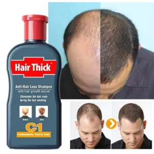 Hair Growth 100ml Anti-Hair Loss Shampoo Thick Fast Growth Herbal Serum Herbal For Men
