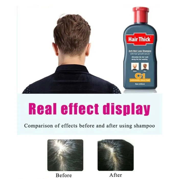 Hair Growth 100ml Anti-Hair Loss Shampoo Thick Fast Growth Herbal Serum Herbal For Men