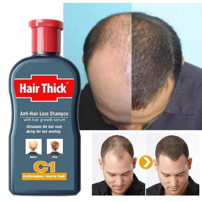 Hair Growth 100ml Anti-Hair Loss Shampoo Thick Fast Growth Herbal Serum Herbal For Men