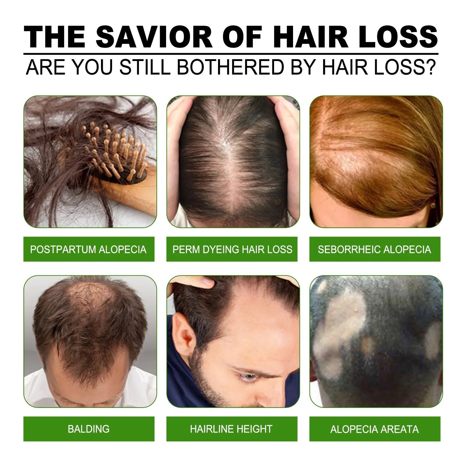 Jaysuing Hair Treatment, Strengthens Hair, Nourishes Root Growth And