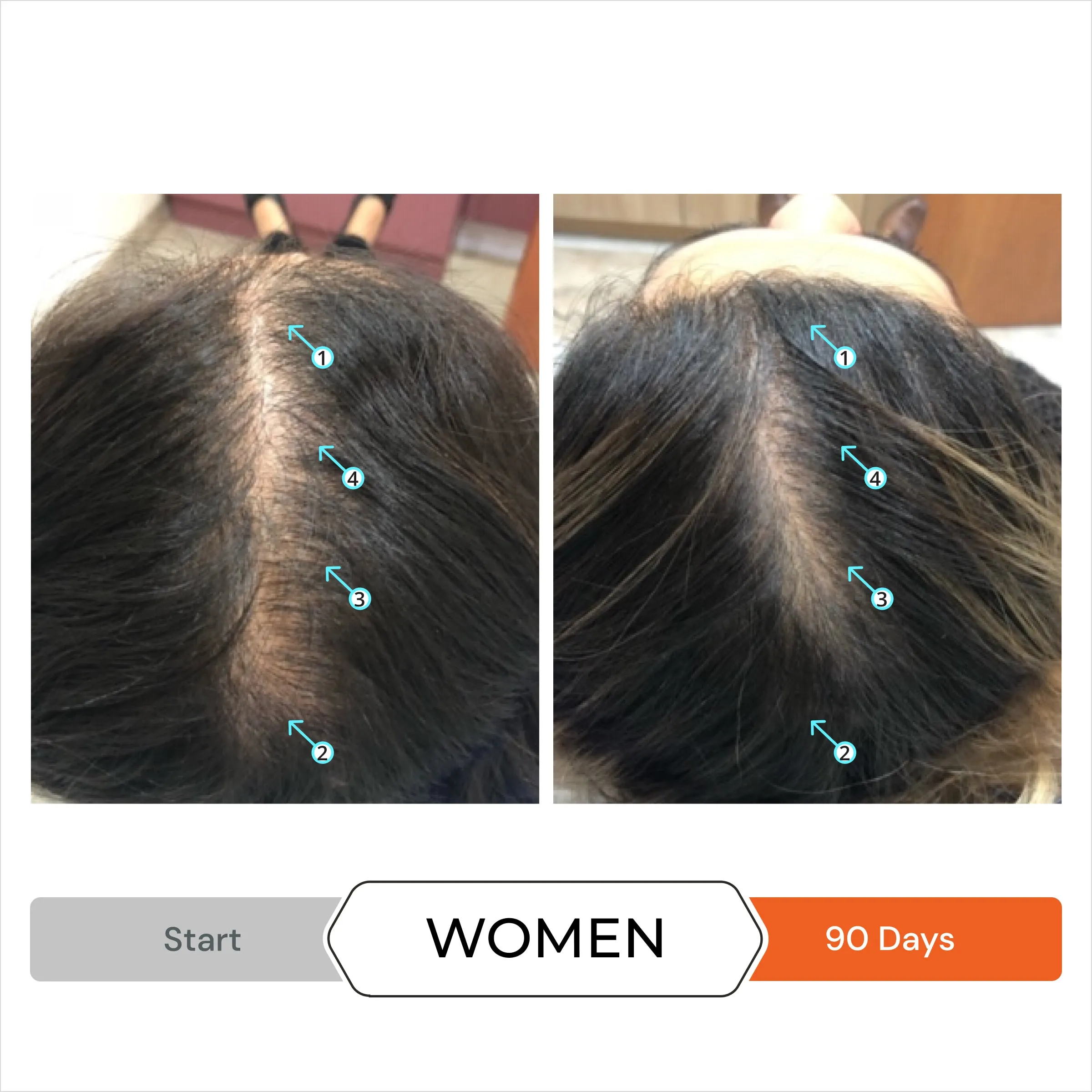 Revita 3 Pack - 3 Month Supply | Tablets For Hair Revitalization