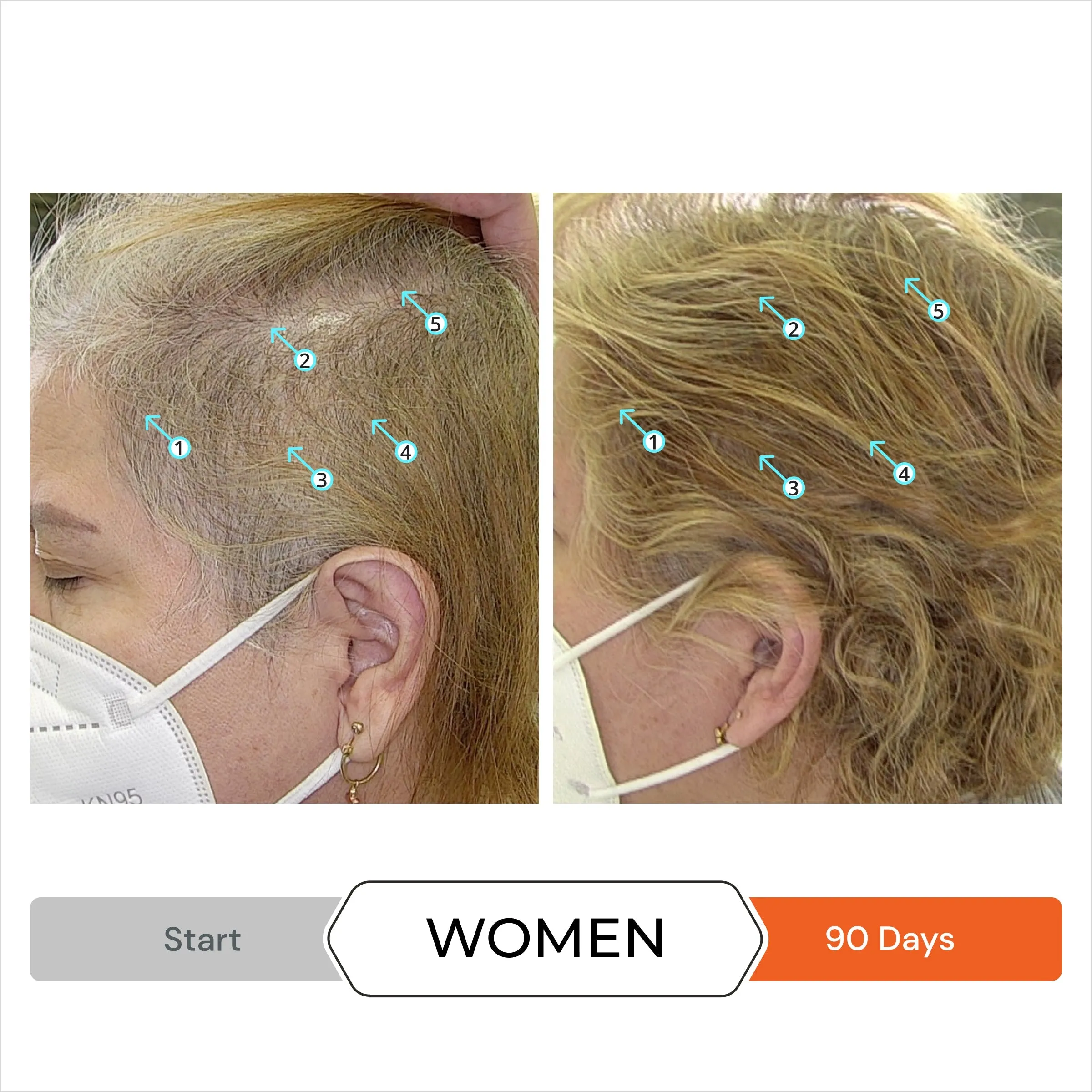 Revita 3 Pack - 3 Month Supply | Tablets For Hair Revitalization