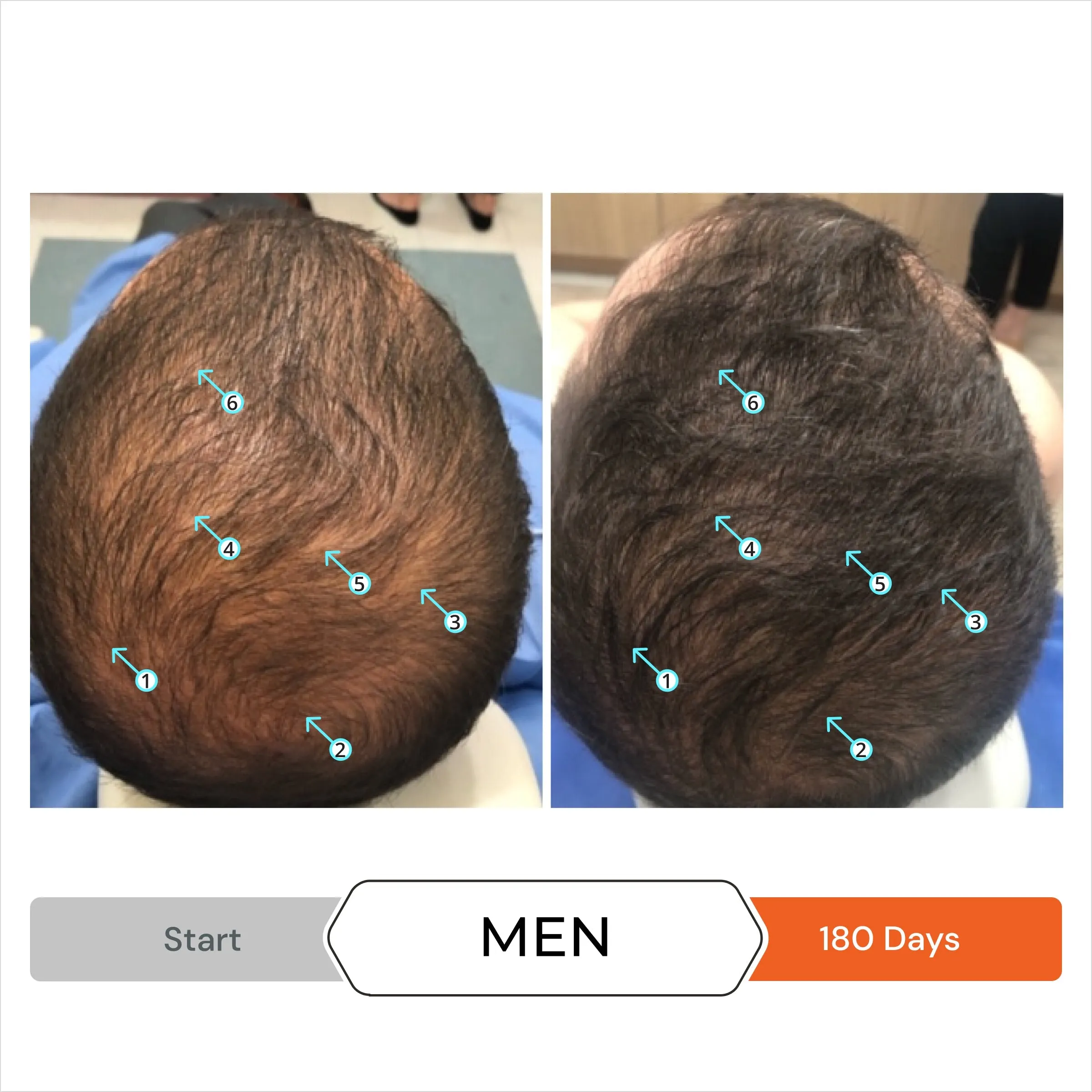 Revita 3 Pack - 3 Month Supply | Tablets For Hair Revitalization