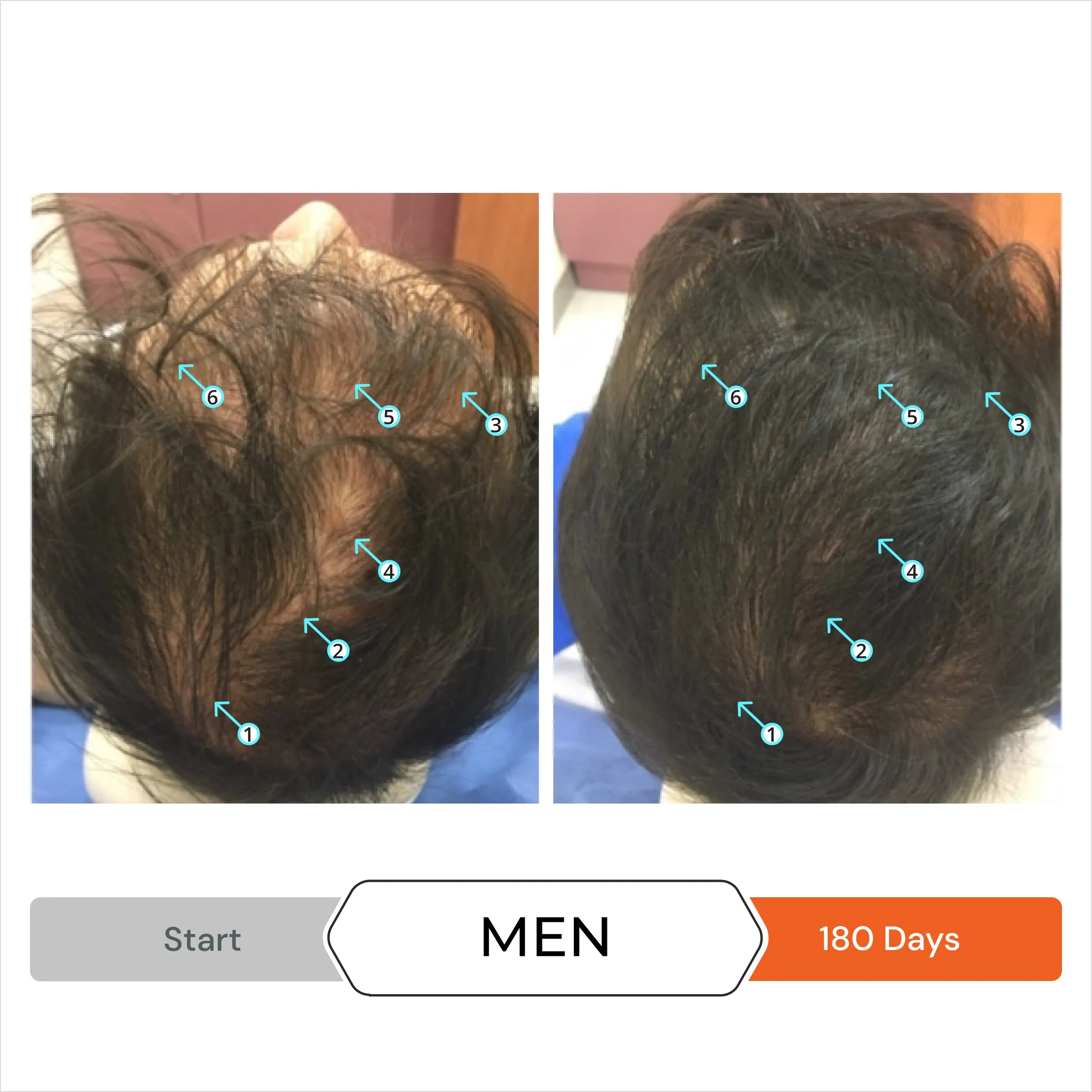 Revita 3 Pack - 3 Month Supply | Tablets For Hair Revitalization