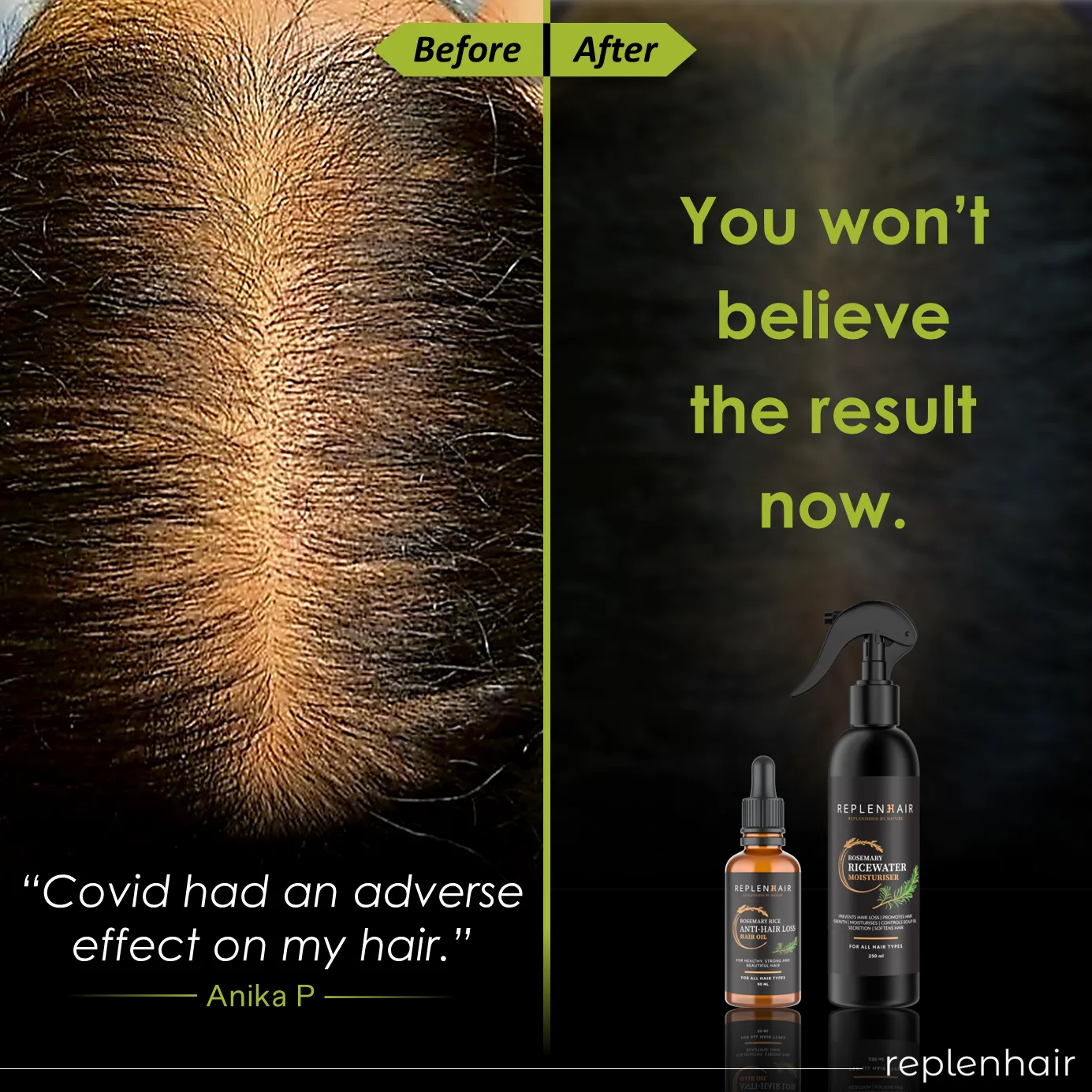 Rosemary Rice Water Anti-Hair Loss Bundle | Reduces Hair Loss