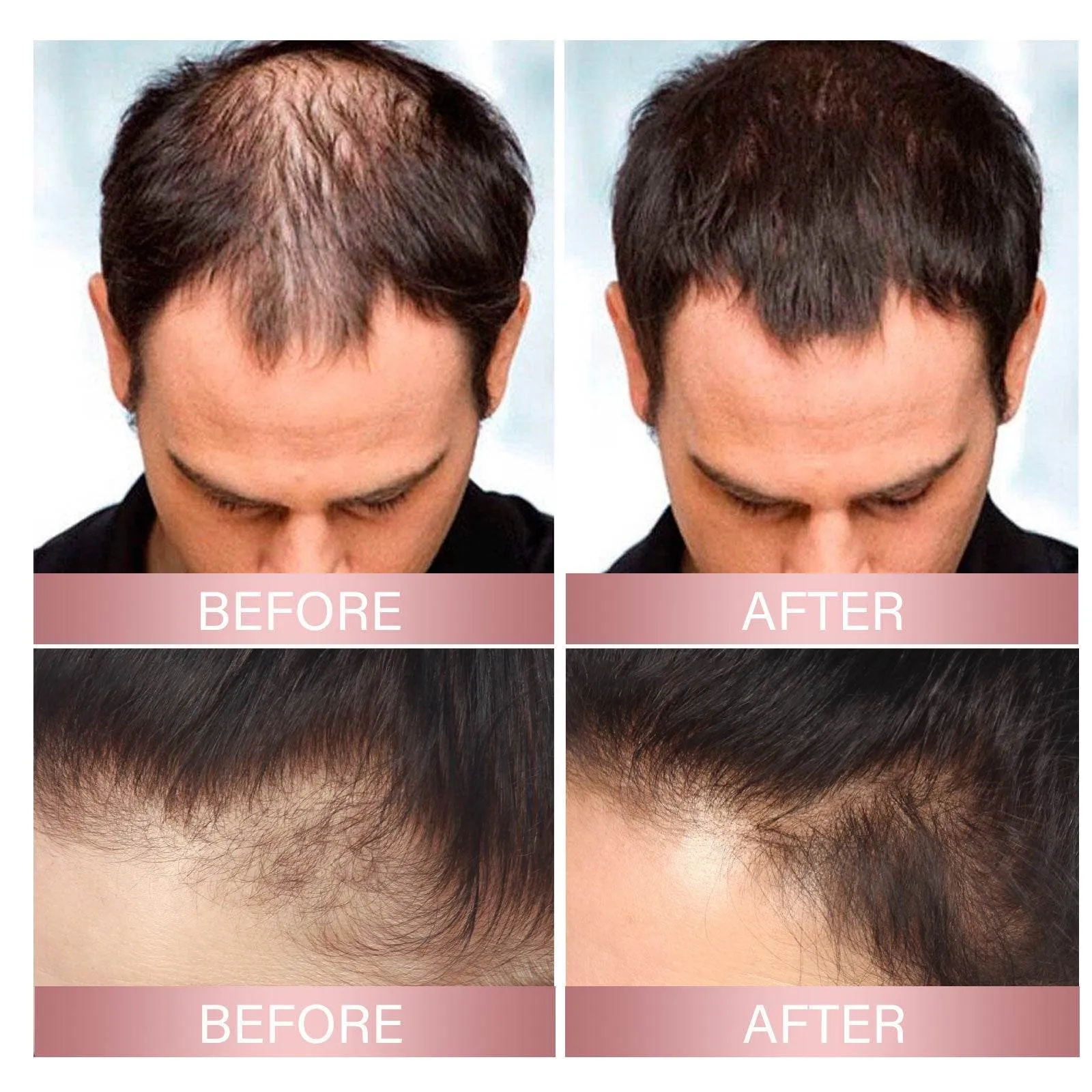 Strong Repair Rice Dense Hair Spray Hair Follicle Hair Root Anti-drop